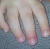 post-189-0-41600600-1485623079_thumb.jpg