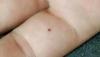 post-49-0-69655300-1483287629_thumb.jpg