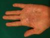post-2009-0-28424100-1516317881_thumb.jpg
