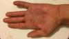post-2009-0-88671200-1516102220_thumb.jpg