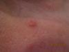 post-51-0-02289400-1488201156_thumb.jpg