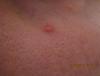 post-51-0-45191500-1488201154_thumb.jpg