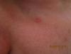 post-51-0-76015900-1488201066_thumb.jpg