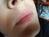 post-121-0-44836300-1518796048_thumb.jpg