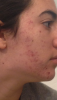 post-233-0-46299600-1488582691_thumb.png