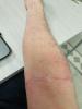 post-235-0-87937000-1488741376_thumb.jpg