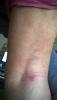 post-241-0-13006400-1489484067_thumb.jpg