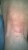 post-241-0-44835000-1489484068_thumb.jpg