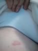 post-3190-0-57075200-1520964790_thumb.jpg