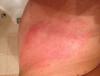 post-296-0-56265100-1493978069_thumb.jpg