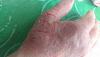 post-302-0-10919200-1494481052_thumb.jpg