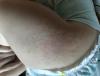 post-305-0-54086500-1494796868_thumb.jpg