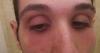 post-320-0-50534200-1495137309_thumb.jpg