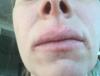 post-322-0-07525700-1496166234_thumb.jpg