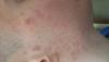 post-5580-0-23614200-1525707985_thumb.jpg