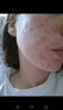 post-7549-0-50705600-1527576514_thumb.png