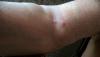 post-345-0-64827200-1497441964_thumb.jpg