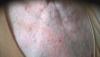 post-345-0-77705000-1497441966_thumb.jpg