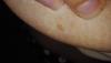 post-49-0-41733300-1498486289_thumb.jpg
