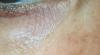 post-5611-0-88827800-1530042263_thumb.jpg