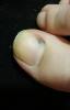 post-8466-0-03051000-1529095830_thumb.jpg
