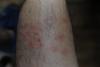 post-8616-0-36111800-1529311115_thumb.jpg