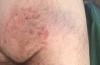 post-8616-0-63127800-1529311311_thumb.jpg
