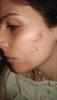 post-8627-0-09064000-1530362809_thumb.jpeg