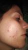 post-8627-0-95739700-1530362836_thumb.jpeg