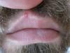 post-51-0-50860600-1469097045_thumb.jpg