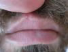 post-51-0-88733800-1469097033_thumb.jpg