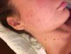 post-291-0-79648300-1504118455_thumb.jpeg