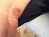 post-12007-0-39616900-1535289875_thumb.jpg