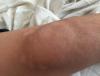post-12007-0-46941300-1534604862_thumb.jpg