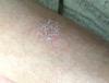 post-12007-0-70917400-1535032304_thumb.jpg