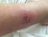 post-12007-0-92224400-1534604742_thumb.jpg