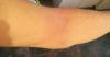 post-12766-0-60649200-1535449894_thumb.jpg