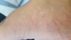 post-100-0-87683400-1474313921_thumb.jpg