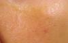 post-78-0-42278300-1473519977_thumb.jpg