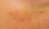 post-78-0-82599900-1473519926_thumb.jpg
