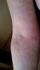 post-388-0-89008500-1504712671_thumb.jpg