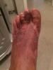 post-395-0-69579900-1505387286_thumb.jpg