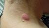post-11348-0-41055900-1537816789_thumb.jpg