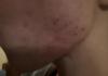 post-13221-0-70323400-1536090935_thumb.jpg