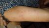 post-11348-0-65871600-1538513356_thumb.jpg