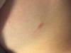 post-142-0-28358100-1479909054_thumb.jpg