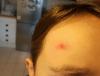 post-121-0-75146600-1510418824_thumb.jpg
