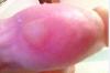 post-148-0-20571600-1480581735_thumb.jpg