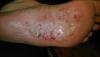 post-1514-0-10442900-1514467423_thumb.jpeg