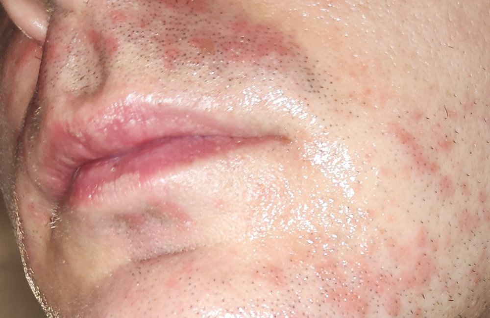 22.thumb.jpg.352ec01b7a5eaa53b849a4a691f161f2.jpg